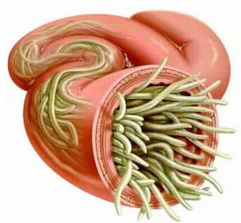 Human parasitic symptoms and treatment