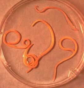 Parasites of the Ascaride man