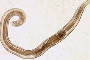 The parasite of a man is cut