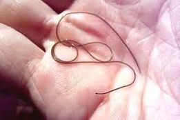Parasites in your palm