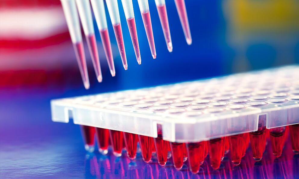 Blood test enzyme immunoassay - method of diagnosing parasitic infections